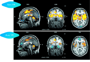 Functional MRI of brain activity with and without virtual reality.