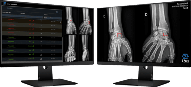 AZmed uses artificial intelligence to provide diagnostic assistance in standard radiology.