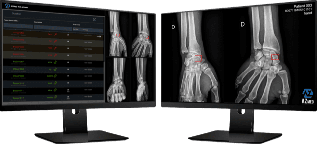 L'entreprise AZmed utilise l'intelligence artificielle pour apporter une aide au diagnostic en radiologie standard.