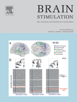 Clinical study published in the Journal of Brain Simulation