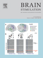 Klinische studie gepubliceerd in het Journal of Brain Simulation